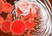 A meszesedés visszafordítása: lehetőségek és módszerek